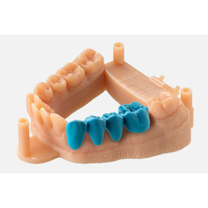 Всё о 3D принтере в стоматологии: особенности, применение, технологии