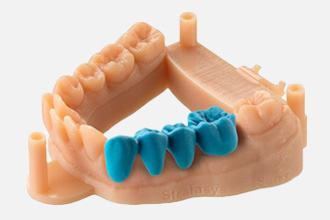 Всё о 3D-принтере в стоматологии: особенности, применение, технологии