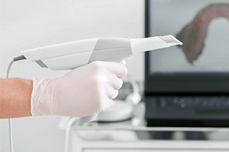3D-сканеры в стоматологии: топовые производители и на что стоит ориентироваться при выборе модели