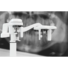Правила размещения рентген-аппаратов в стоматологиях в 2022 году