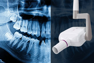 Правила размещения рентген-аппаратов в стоматологиях в 2023 году