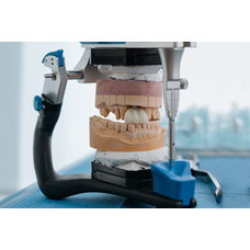 Типы стоматологических артикуляторов: полурегулируемые и регулируемые