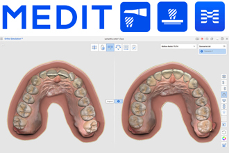 Обзор приложений для интраоральных сканеров Medit: инновации 2024 года
