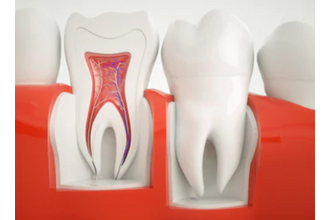 Электроодонтодиагностика в современной стоматологии