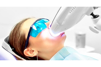 Philips Zoom 4 – инновационная система отбеливания зубов в клинике и дома