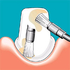 Sonicflex clean brush №4 - насадка-щетка конус большой для чистки зубов | KaVo (Германия)