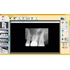 FONA CDR powered by SCHICK - система компьютерной стоматологической радиографии | FONA Dental s.r.o. (Италия)