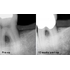 FONALaser - стоматологический диодный лазер | FONA Dental s.r.o. (Италия)
