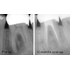FONALaser - стоматологический диодный лазер | FONA Dental s.r.o. (Италия)