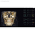 OP 3D Vision - аппарат панорамный рентгеновский стоматологический с функцией томографии | KaVo (Германия)
