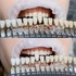 Amazing White Premium Teeth Whitening Kit 38% - набор для клинического отбеливания | Amazing White (США)