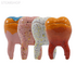 Декоративный зуб из керамики с крышкой, малый, цветной