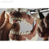 Модель челюсти для практики проведения местной анестезии | Dentalstore (Италия)