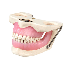 Модель челюсти для практики проведения местной анестезии