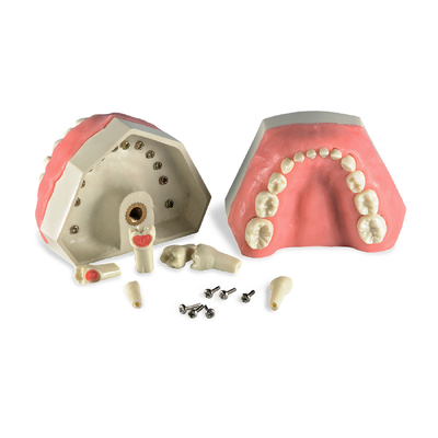 Модель детских верхней и нижней челюсти со сменным прикусом, для практики пульпэктомии | Dentalstore (Италия)