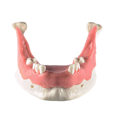 Модель нижней челюсти с дефектами зубного ряда для проведения имплантации, с десной
