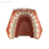 Модель верхней и нижней челюсти для крепления в фантомную голову, 32 зуба | Dentalstore (Италия)