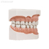 Модель верхней и нижней челюсти для крепления в фантомную голову, 32 зуба | Dentalstore (Италия)