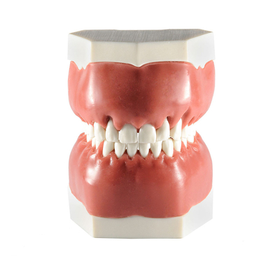 Модель верхней и нижней челюсти для отработки навыков закрытия рецессии | Dentalstore (Италия)