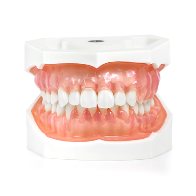 Модель верхней и нижней челюсти с патологией пародонта во фронтальном отделе | Dentalstore (Италия)