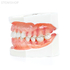 Модель верхней и нижней челюсти с патологией пародонта во фронтальном отделе | Dentalstore (Италия)