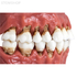 Модель верхней и нижней челюсти с различными патологиями | Dentalstore (Италия)