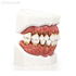 Модель верхней и нижней челюсти с различными патологиями | Dentalstore (Италия)