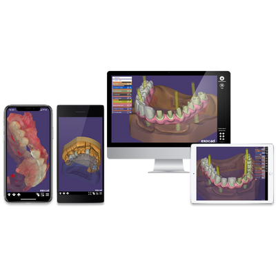 Exocad 2018 Valletta - программное обеспечение для компьютерного моделирования стоматологических реставраций | Exocad (Германия)