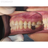 EduCam - миниатюрная стоматологическая видеокамера | Futudent (Финляндия)