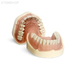E02 – модель верхней и нижней челюсти для практики | GF Dental (Италия)
