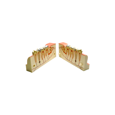 DM21 – увеличенная модель нижней челюсти с кариесом в разрезе | GF Dental (Италия)