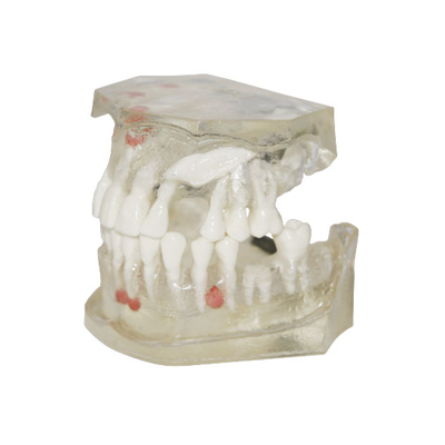 E04T – демонстрационная хирургическая модель верхней и нижней челюсти | GF Dental (Италия)