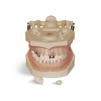 E12N – модель верхней и нижней челюсти с артикулятором для пародонтологической практики | GF Dental (Италия) 