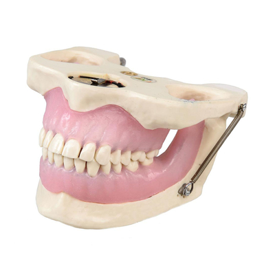 E15 – модель верхней и нижней челюсти для практики анестезии | GF Dental (Италия) 