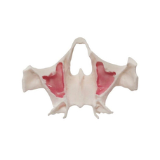 E36 – точная анатомическая модель верхней челюсти для практики скуловых имплантов