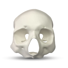 E51 – модель верхней челюсти, скул и лобной кости для практики скуловых имплантов