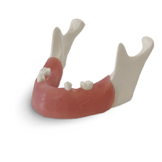 E82 – модель нижней челюсти для практики установки имплантатов