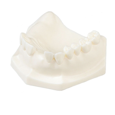 E85 – модель верхней челюсти с частичной адентией для практики имплантологии