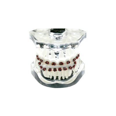 OTB4 – прозрачная ортодонтическая модель с брекетами и твердой десной, 3 класс | GF Dental (Италия) 
