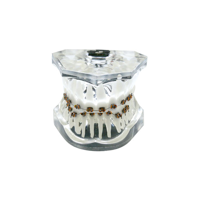 OTB6 – прозрачная ортодонтическая модель с брекетами и твердой десной, 2 класс | GF Dental (Италия) 