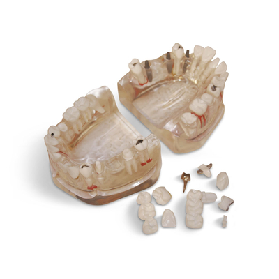 T09 – демонстрационная модель верхней и нижней челюсти увеличенная 3:1, с различным патологиями | GF Dental (Италия)