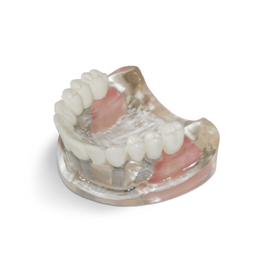 T10 – демонстрационная модель верхней челюсти с 6 имплантами и протезом | GF Dental (Италия)