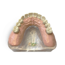 T12 – демонстрационная модель верхней челюсти с имплантами
