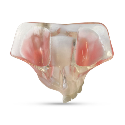 T21 – демонстрационная модель верхней челюсти с атрофией альвеолярного гребня | GF Dental (Италия)