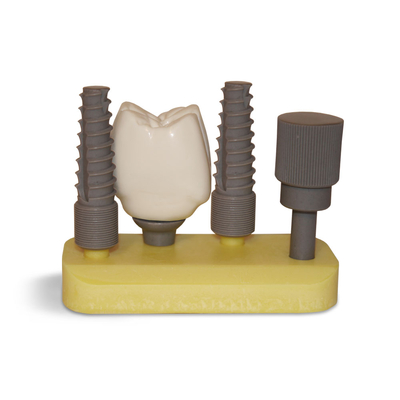 DM18 – увеличенная модель импланта, высота 9 см | GF Dental (Италия)