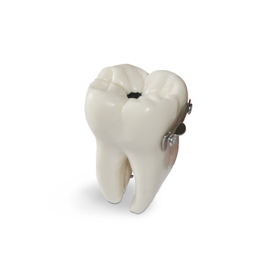 DM22 – увеличенная модель моляра в разрезе для демонстрации развития кариеса,  высота 10 см. | GF Dental (Италия)