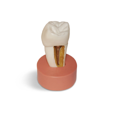 DM26 – увеличенная модель зуба со вкладкой для демонстрации, высота 9 см