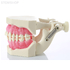 DM04 – модель верхней и нижней челюсти для демонстрации, в артикуляторе | GF Dental (Италия)