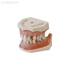 E06  – модель верхней и нижней челюсти с кариесом корня и патологией пародонта | GF Dental (Италия) 