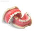 E826  – модель верхней и нижней челюсти с пародонтопатологией для практики | GF Dental (Италия) 
